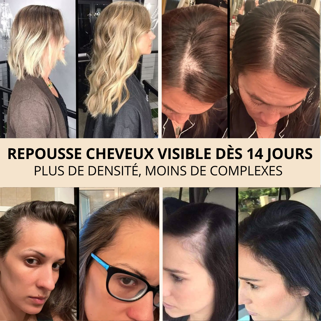 Sérum de Croissance Naturel pour Cheveux