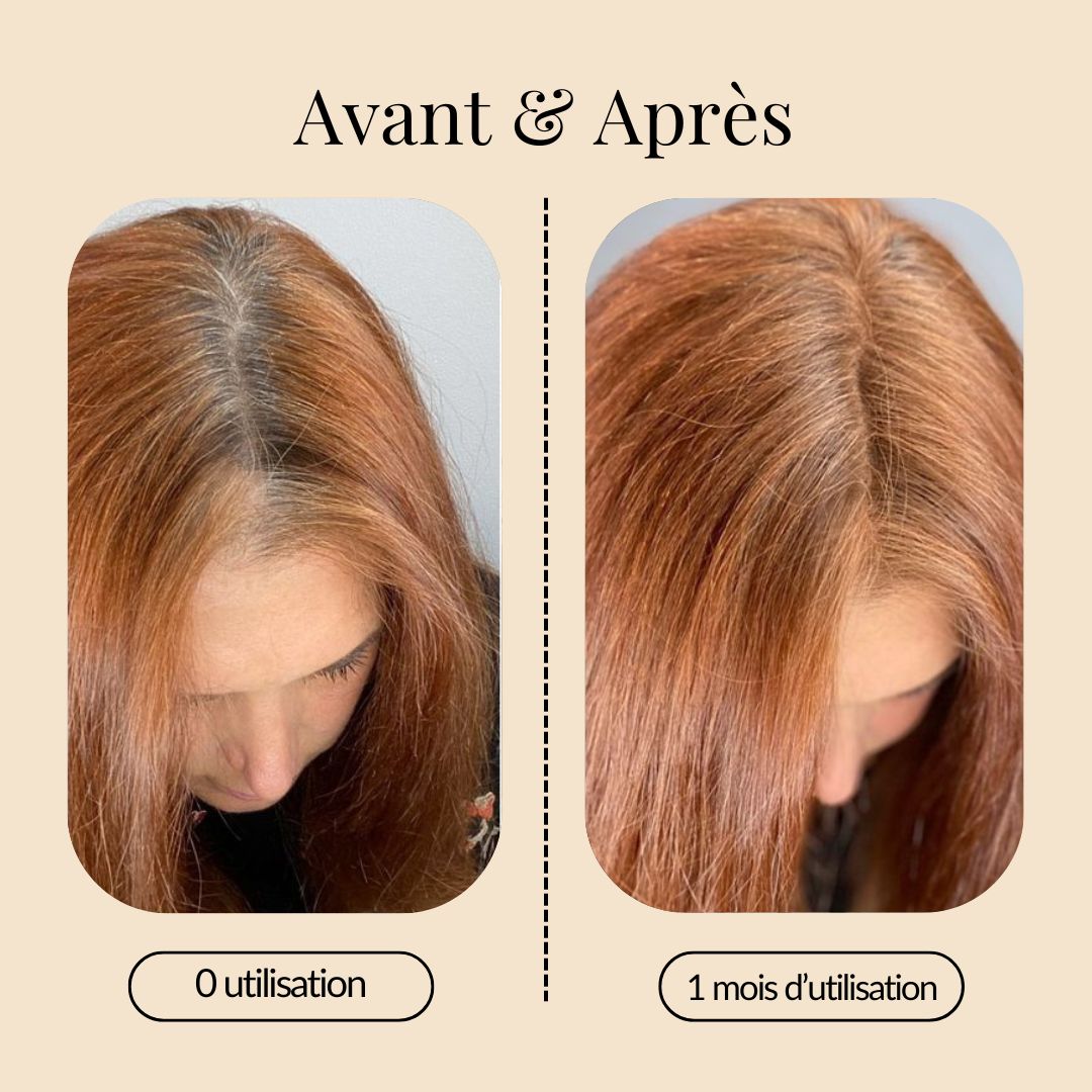 Sérum de Croissance Naturel pour Cheveux