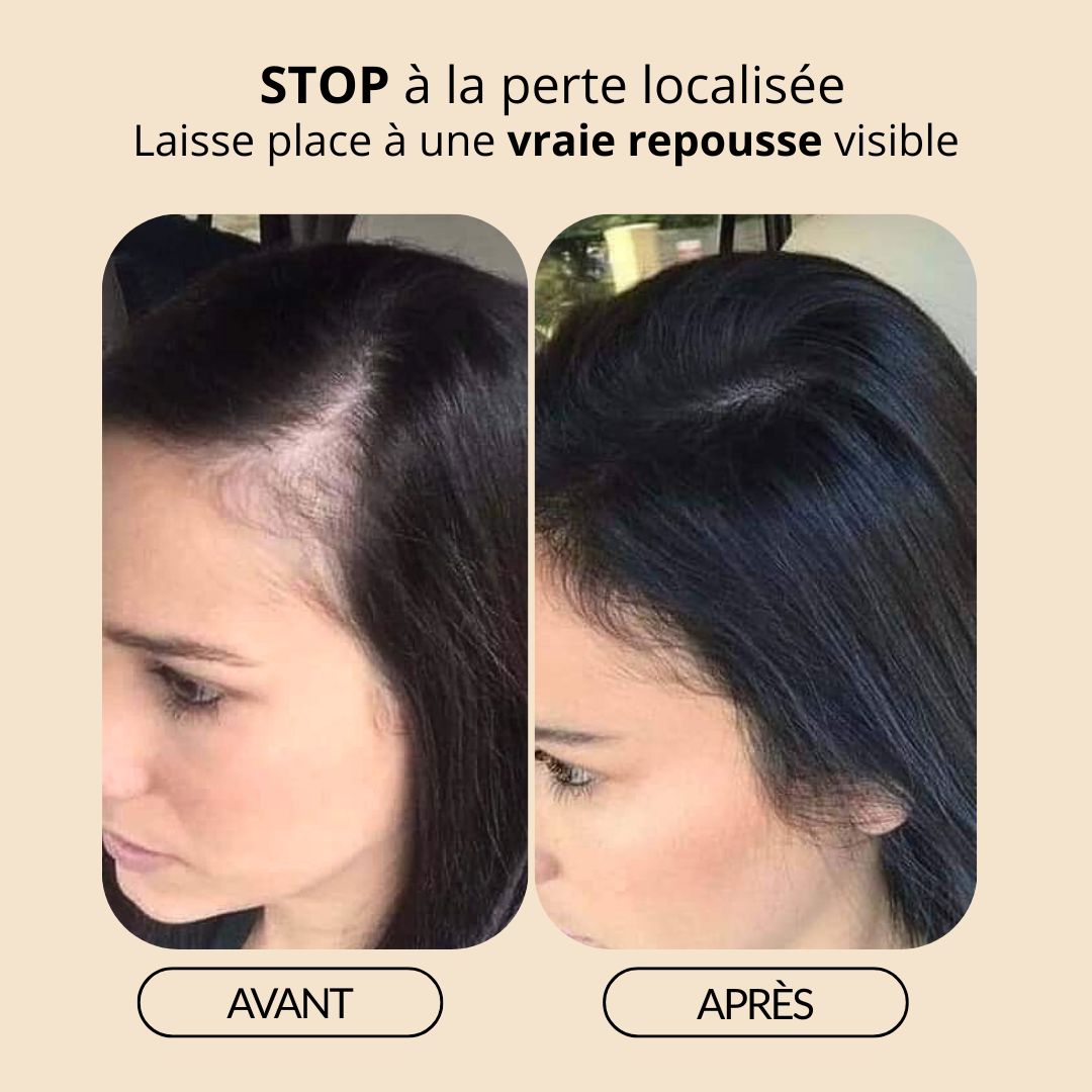 Sérum de Croissance Naturel pour Cheveux